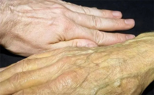详细介绍