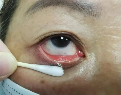 详细介绍