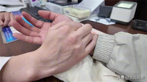 详细说明