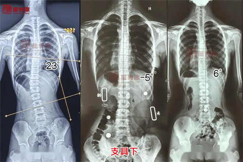 细节呈现