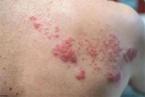 详细介绍
