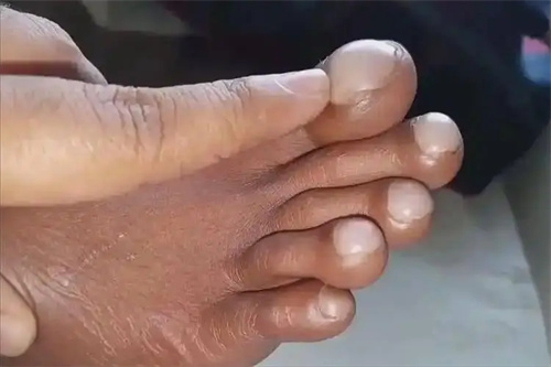 细节说明