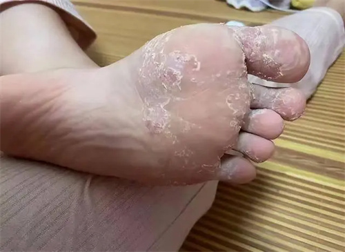 详细描述