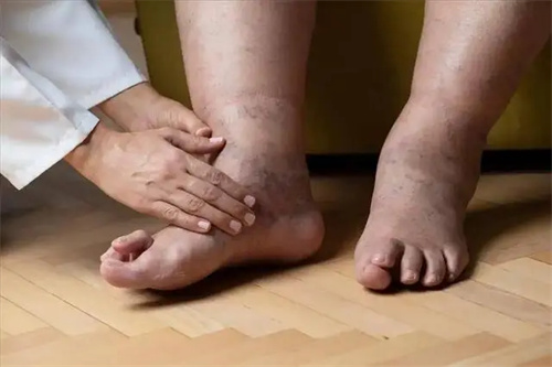 细节介绍