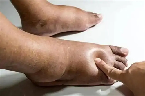 详细说明