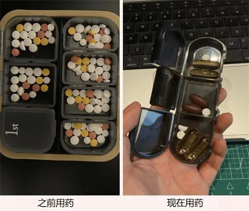 细节介绍