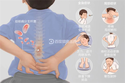 图片细节