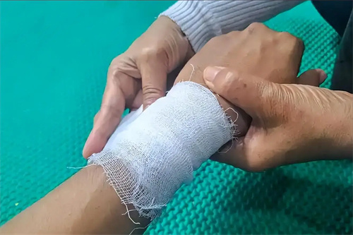 详细说明