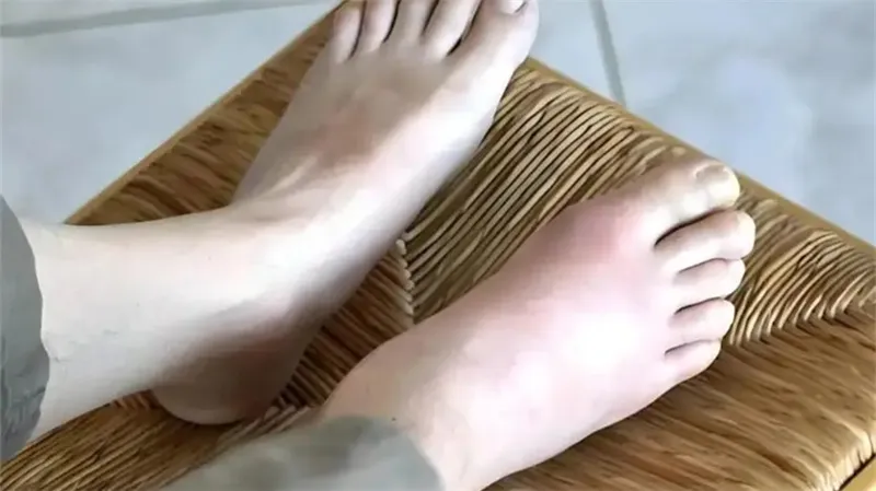 细节描述
