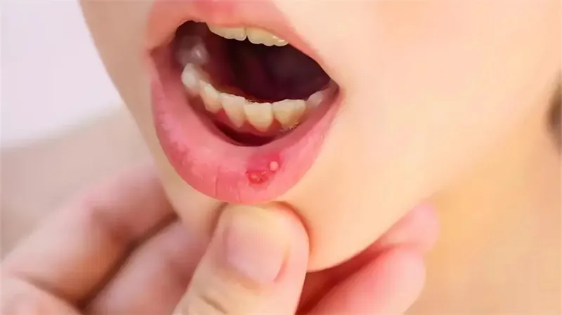 细节呈现