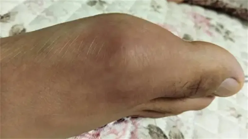 详细介绍