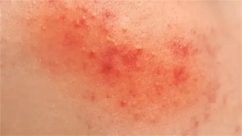 详细说明